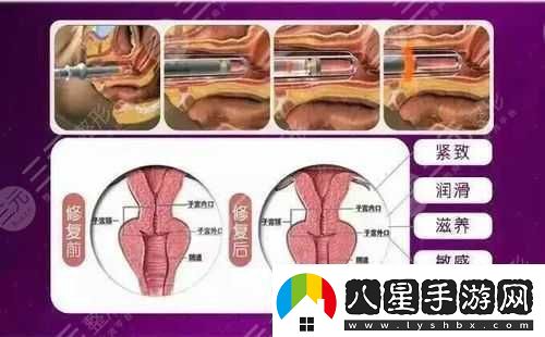 歐洲之星私密緊致