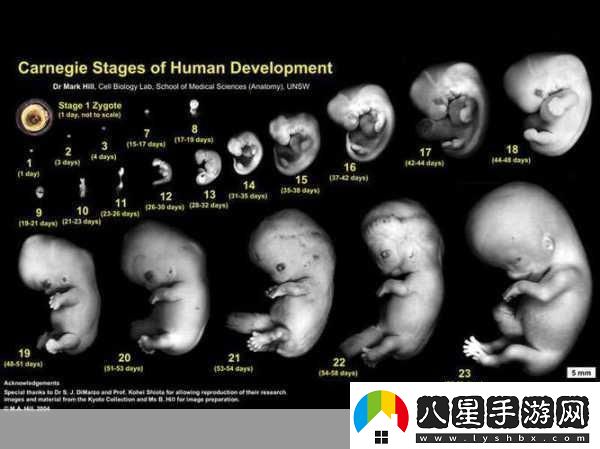 雙腿間硬硬的胎頭濕漉漉的擠出來的情況如何應對1.如何應對胎頭擠出時的緊急情況